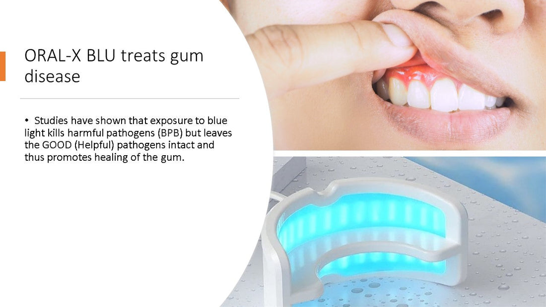 Dementia linked to gum disease – exploring the impact of Blue Light Technology