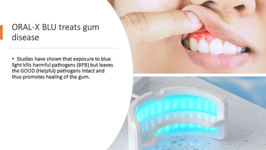 Dementia linked to gum disease – exploring the impact of Blue Light Technology